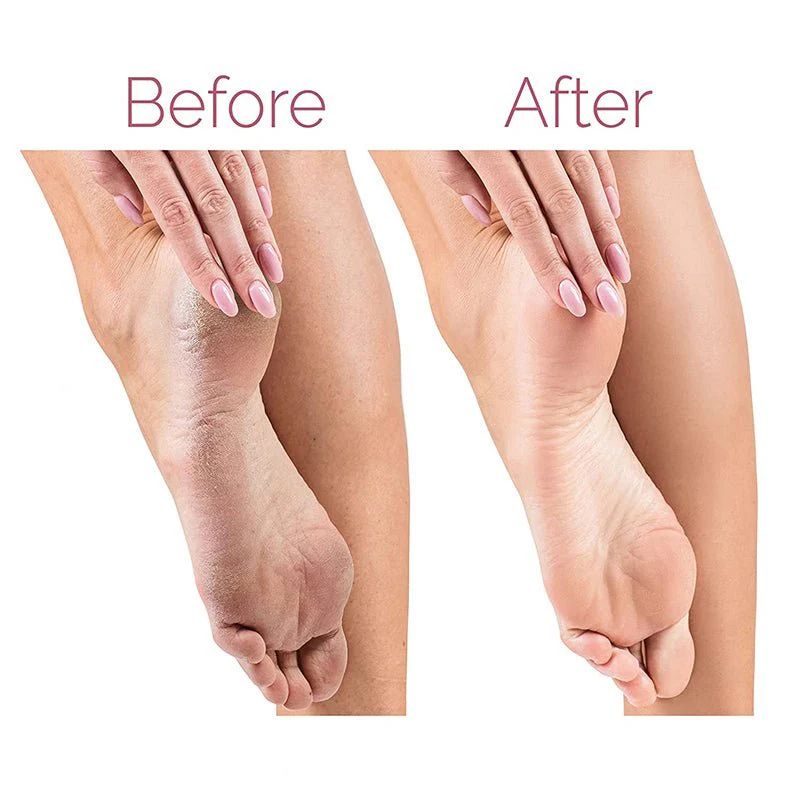 Electric Pedicure Foot File – Callus & Dead Skin Remover | UAE Beauty