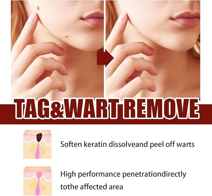 Tags & Moles Remover